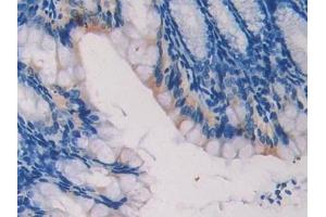Immunohistochemistry (IHC) image for anti-Laminin, beta 2 (Laminin S) (LAMB2) (AA 1498-1716) antibody (ABIN7438904)
