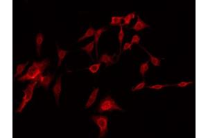 ABIN6274416 staining Hela by IF/ICC. (AKAP14 抗体  (N-Term))