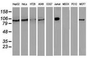 Image no. 1 for anti-Transforming, Acidic Coiled-Coil Containing Protein 3 (TACC3) antibody (ABIN1498095) (TACC3 抗体)