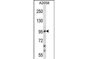 Western blot analysis in A2058 cell line lysates (35ug/lane). (E2F7 抗体  (AA 591-619))