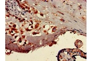 Immunohistochemistry of paraffin-embedded human placenta tissue using ABIN7171919 at dilution of 1:100 (TTC27 抗体  (AA 590-817))