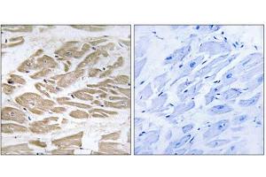 Immunohistochemistry analysis of paraffin-embedded human heart tissue using BRP44L antibody. (BRP44L 抗体  (N-Term))