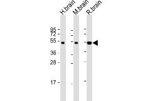All lanes : Anti-NPTX1- Antibody at 1:2000 dilution Lane 1: human brain lysate Lane 2: mouse brain lysate Lane 3: rat brain lysate Lysates/proteins at 20 μg per lane.