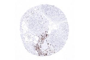 Thymus (Recombinant CD20 抗体)