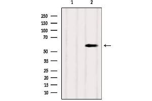 Western blot analysis of extracts from Mouse brain, using SUOX Antibody. (SUOX 抗体  (Internal Region))