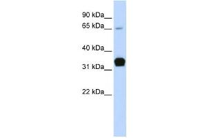 Western Blotting (WB) image for anti-Slow Skeletal Troponin T (TNNT1) antibody (ABIN2458625) (TNNT1 抗体)