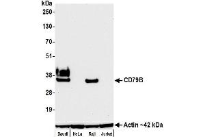 Western Blotting (WB) image for anti-CD79b Molecule, Immunoglobulin-Associated beta (CD79B) (AA 200-250) antibody (ABIN7454006)