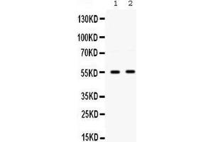 Western blot analysis of GLUT9 expression in HepG2 whole cell lysates (lane 1) and A549 whole cell lysates (lane 2). (SLC2A9 抗体  (Middle Region))