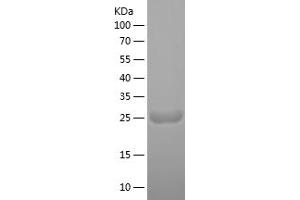 Western Blotting (WB) image for Myosin Light Chain 4, Alkali, Atrial, Embryonic (MYL4) (AA 1-197) protein (His tag) (ABIN7282681) (MYL4 Protein (AA 1-197) (His tag))