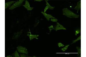 Immunofluorescence of monoclonal antibody to HKDC1 on HeLa cell. (HKDC1 抗体  (AA 102-200))