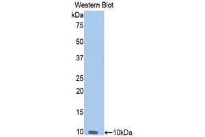 Western blot analysis of the recombinant protein. (NOS2 抗体  (AA 868-909))