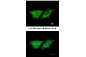 ICC/IF Image Immunofluorescence analysis of methanol-fixed HeLa, using LOC80129, antibody at 1:200 dilution. (CCDC170 抗体  (C-Term))