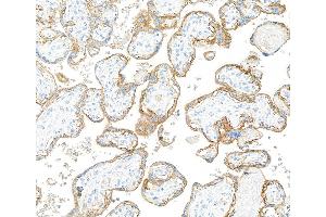 Immunohistochemistry (IHC) image for anti-Epidermal Growth Factor Receptor (EGFR) (C-Term) antibody (ABIN7795642)