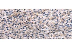 Immunohistochemistry of paraffin-embedded Human brain tissue using ANGPTL2 Polyclonal Antibody at dilution of 1:55(x200) (ANGPTL2 抗体)