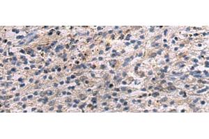 Immunohistochemistry of paraffin-embedded Human brain tissue using ANGPTL2 Polyclonal Antibody at dilution of 1:55(x200) (ANGPTL2 抗体)