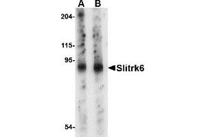 Western Blotting (WB) image for anti-SLIT and NTRK-Like Family, Member 6 (SLITRK6) (Middle Region) antibody (ABIN1031100)