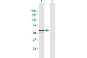 Western Blot analysis of BBS4 expression in transfected 293T cell line by BBS4 MaxPab polyclonal antibody. (BBS4 抗体  (AA 1-519))