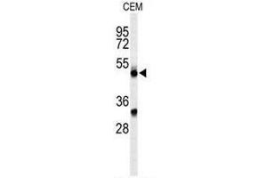 Western blot analysis of CFP Antibody (Center) in CEM cell line lysates (35µg/lane). (CFP 抗体  (Middle Region))