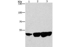 Western Blot analysis of Hela, hepG2 and 231 cell using CTBP2 Polyclonal Antibody at dilution of 1:400 (CTBP2 抗体)