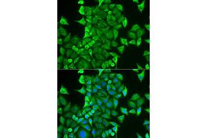Immunofluorescence analysis of HeLa cell using CARS antibody. (CARS 抗体)