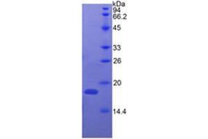 SDS-PAGE analysis of Cow Ribonuclease A Protein. (RNASE1 蛋白)