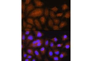 Immunofluorescence analysis of HeLa cells using GSTT2B Rabbit pAb (ABIN7267450) at dilution of 1:100.