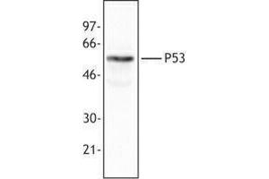Western Blotting (WB) image for anti-Tumor Protein P53 (TP53) antibody (ABIN2664003) (p53 抗体)