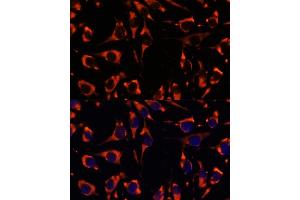 Immunofluorescence analysis of L929 cells using INPP5E antibody (ABIN7267883) at dilution of 1:100. (INPP5E 抗体  (AA 510-630))