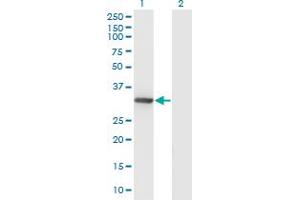 Western Blot analysis of DNALI1 expression in transfected 293T cell line by DNALI1 monoclonal antibody (M04A), clone 2H3. (DNALI1 抗体  (AA 1-258))