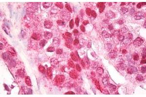 Anti-CNOT4 / CLONE243 antibody IHC staining of human prostate.