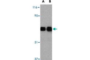 Western blot analysis of TLR10 in human lymph node tissue lysates with TLR10 polyclonal antibody  at (A) 0. (TLR10 抗体  (Internal Region))