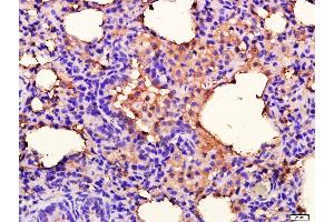 Rat lung lysates probed with ANKK1 Polyclonal Antibody, unconjugated  at 1:400 overnight at 4°C followed by a conjugated secondary antibody for 20 minutes at 37°C. (ANKK1 抗体  (AA 101-200))
