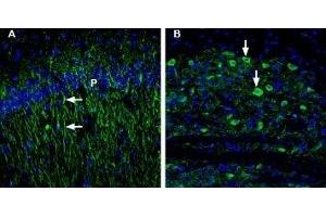 Expression of 5-Hydroxytryptamine receptor 1B in rat and mouse brain - Immunohistochemical staining of rat and mouse brain sections using Anti-5HT1B Receptor (HTR1B) (extracellular) Antibody (ABIN7043616, ABIN7045280 and ABIN7045281), (1:200). (5HT1B Receptor 抗体  (Extracellular, N-Term))