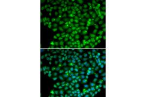 Immunofluorescence analysis of U2OS cells using MUTYH antibody (ABIN5970784). (MUTYH 抗体)
