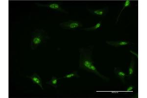 Immunofluorescence of monoclonal antibody to RPL7 on HeLa cell. (RPL7 抗体  (AA 158-248))