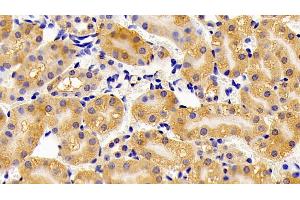 Detection of HADH in Mouse Kidney Tissue using Polyclonal Antibody to Hydroxyacyl Coenzyme A Dehydrogenase (HADH) (HADH 抗体  (AA 1-167))