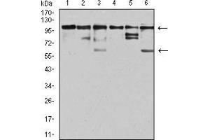 Western Blotting (WB) image for anti-ZFP91 Zinc Finger Protein (ZFP91) (AA 162-304) antibody (ABIN5542699)