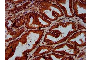 IHC image of ABIN7151584 diluted at 1:600 and staining in paraffin-embedded human prostate tissue performed on a Leica BondTM system. (ELP4 抗体  (AA 117-223))
