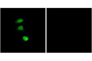 Immunofluorescence analysis of COS7 cells, using IRS-1 (Phospho-Ser307) Antibody. (IRS1 抗体  (pSer307))
