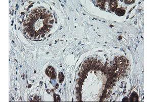 Image no. 11 for anti-Tripartite Motif Containing 44 (TRIM44) antibody (ABIN1501505)