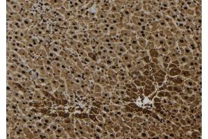 ABIN6277063 at 1/100 staining Mouse liver tissue by IHC-P. (FGFR1 抗体  (C-Term))