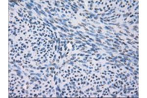 Image no. 8 for anti-Fc gamma RII (CD32) antibody (ABIN1497255) (Fc gamma RII (CD32) 抗体)