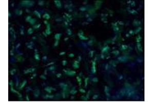 Image no. 1 for anti-Lamin A/C (LMNA) antibody (ABIN335389) (Lamin A/C 抗体)