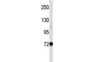Pak7 antibody western blot analysis in mouse stomach tissue lysate (PAK7 抗体  (AA 128-157))