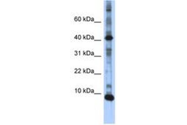 LSM6 Antikörper  (N-Term)