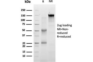 SDS-PAGE Analysis of Purified RET Mouse Monoclonal Antibody (RET/2663). (Ret Proto-Oncogene 抗体  (AA 702-848))