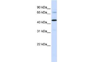 WB Suggested Anti-SFXN4 Antibody Titration: 0. (Sideroflexin 4 抗体  (C-Term))