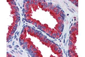 Immunohistochemistry (IHC) image for anti-Klotho (KL) (Middle Region) antibody (ABIN2776875) (Klotho 抗体  (Middle Region))