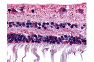Anti-RGR antibody IHC of human retina. (RGR 抗体  (Extracellular Domain))