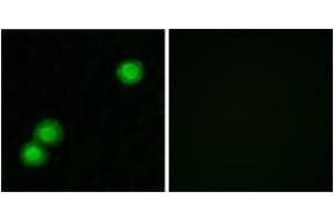 Immunofluorescence analysis of MCF7 cells, using IPKB Antibody. (PKIB 抗体  (AA 29-78))